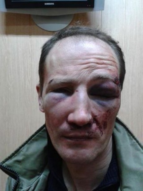 Giáo sư, tiến sĩ của trường đại học tổng hợp Odessa bị cướp tấn công và đánh đập dã man