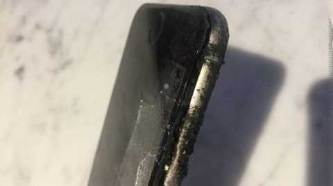 iPhone 6 bốc cháy, 'nướng' cháy cả mảng da đùi