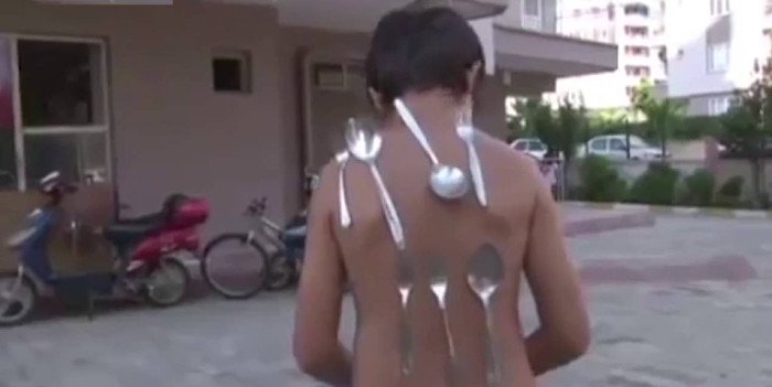 Cậu bé 9 tuổi biến thành "cục nam châm" mỗi khi tức giận