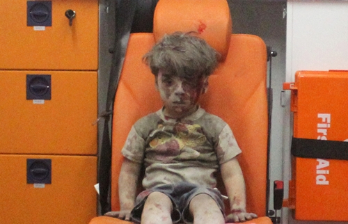 Mỹ gọi cậu bé Syria bị thương là 'bộ mặt thật của chiến tranh'