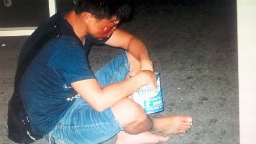 Băng nhóm Trung Quốc đánh què trẻ em và bắt đi ăn xin