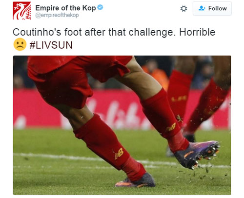 CĐV Liverpool đau lòng vì chấn thương của Coutinho