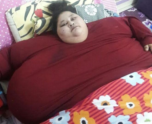 Người phụ nữ nặng 500 kg được cần cẩu đưa vào bệnh viện phẫu thuật