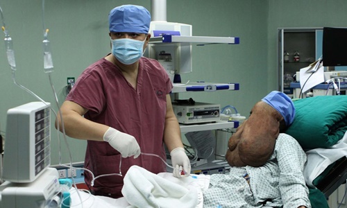 'Người voi' mang khối u 15 kg trên mặt ở Trung Quốc