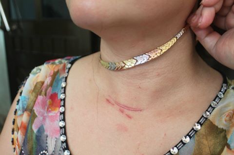 Cảnh sát Chernomorka Odessa bắt tên cướp chuyên giật dây chuyền vàng của phụ nữ.
