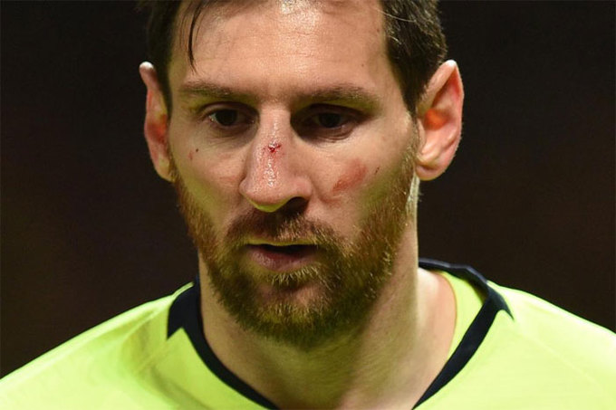 Messi đổ máu trên sân Old Trafford