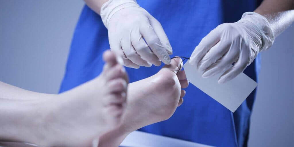 Dnhepr: Tìm thấy xác một nhân viên thực thi pháp luật bị trói vào gốc cây trong rừng, đầu bị chụp túi nilon
