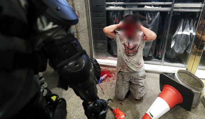 Hong Kong: Kinh hoàng vụ tấn công dao đẫm máu, nghi phạm cắn đứt tai quan chức địa phương