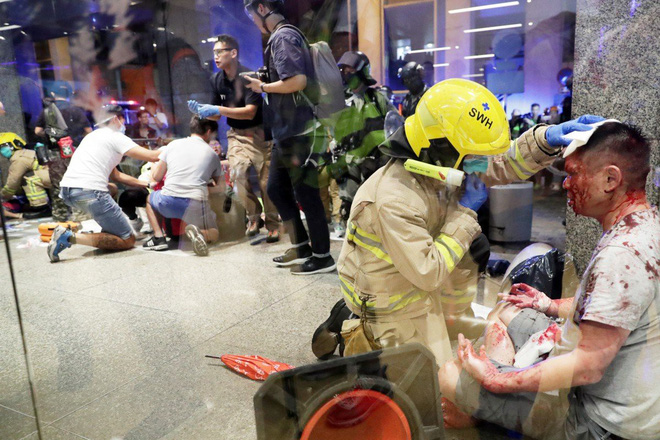 Hong Kong: Kinh hoàng vụ tấn công dao đẫm máu, nghi phạm cắn đứt tai quan chức địa phương