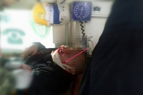 Trong năm 2019, đầu năm 2020 tại vùng chiến sự Donbass 132 binh sĩ Ukraine thiệt mạng, hơn 800 binh sĩ bị thương