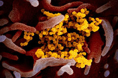 Hình ảnh virus Covid-19 len lỏi trong tế bào người