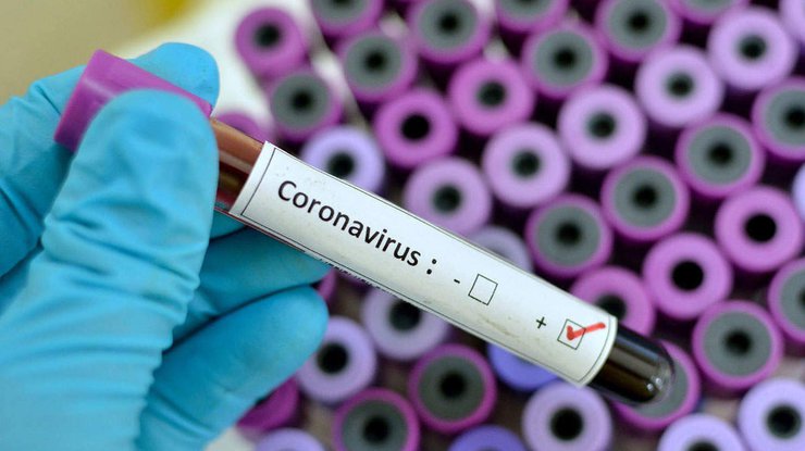 Tại Ukraine có thể mua test thử nhanh để phát hiện Covid-19
