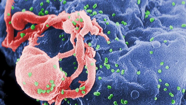 Người thứ 2 trên thế giới được chữa khỏi HIV