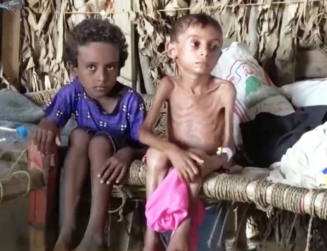 Khoảng 20 triệu người thiếu ăn, Yemen đứng bên bờ vực của nạn đói
