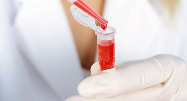 Điều trị bằng huyết tương cung cấp ngay kháng thể cho bệnh nhân COVID-19 để diệt virus