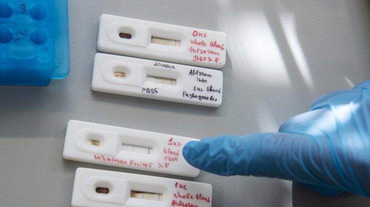 Israel: Xuất hiện test thử nhanh trong 10 giây có thể phát hiện Covid-19
